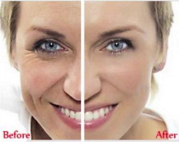 effect hyaluronic acid serum